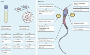 NX GEN SEQUENCING: HEREDITARY MALE INFERTILITY PANEL
