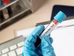 Viral markers