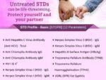 STD PROFILE BASIC