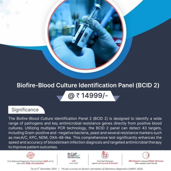BIOFIRE-RESPIRATORY PANEL 2.1