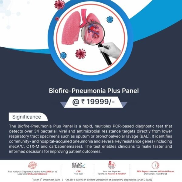 BIOFIRE-PNEUMONIA PLUS PANEL