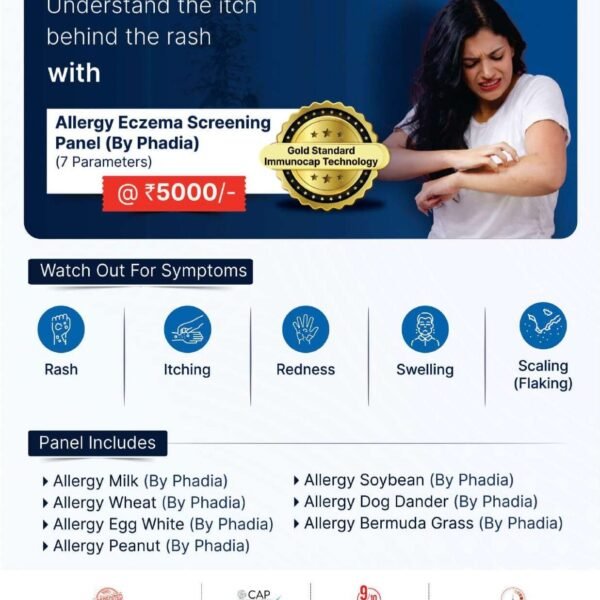 ALLERGY ECZEMA SCREENING PANEL (BY PHADIA)