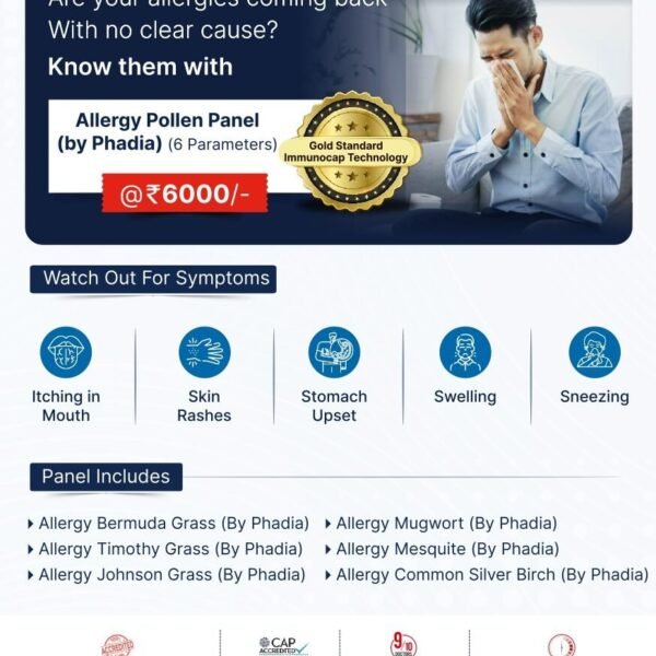 ALLERGY POLLEN PANEL (BY PHADIA)