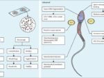 NX GEN SEQUENCING: HEREDITARY OLIGOSPERMIA/AZOOSPERMIA PANEL