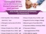 STD PROFILE ADVANCED